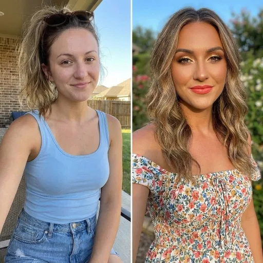 Glow up success story before after